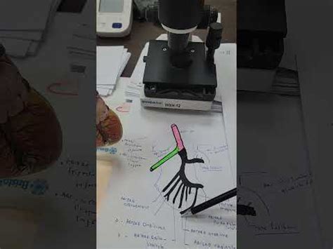 anatomie vascularisation artérielle du pelvis l artère iliaque