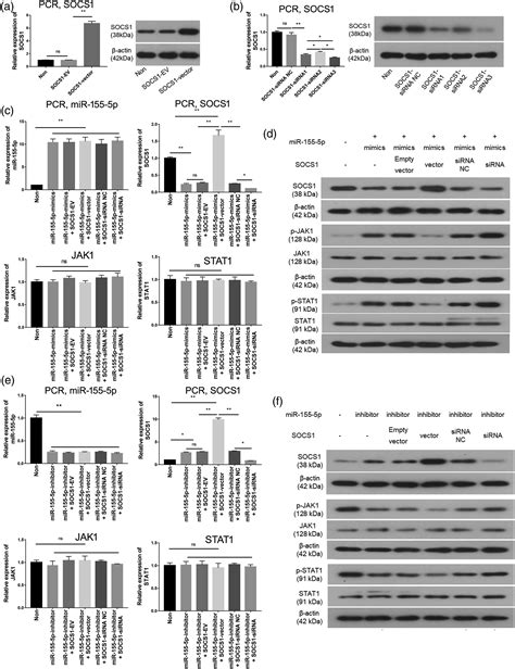 MiR 155 5p SOCS1 JAK1 STAT1 Participates In Hepatic Lymphangiogenesis