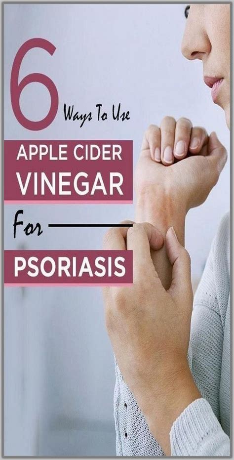 How to Use Apple Cider Vinegar for Psoriasis - Healthy Lifestyle