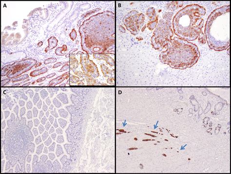 Expression Of Cd A Stem Cell Marker In Pancreatic And Small