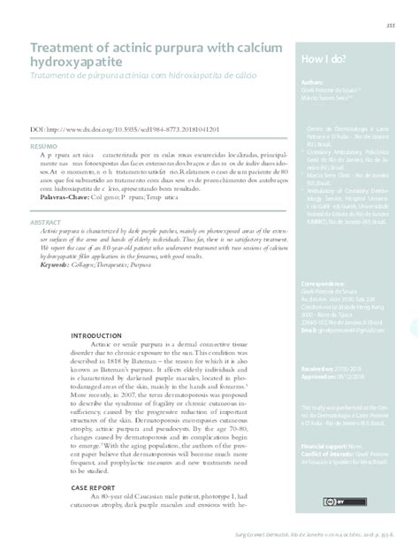 (PDF) Treatment of actinic purpura with calcium hydroxyapatite Tratamento de púrpura actínica ...