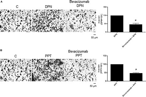 Frontiers Estrogen Receptors Promote Migration Invasion And Colony