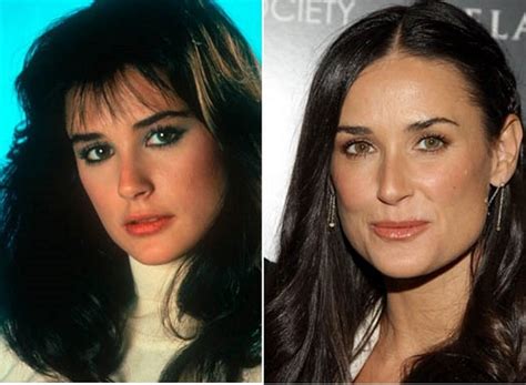 Demi Moore Before and After Plastic Surgery: Face, Boobs, Nose