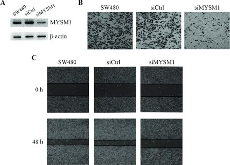 Mysm1 Silencing Decreases Migration And Invasion In Crc Sw480 Cells