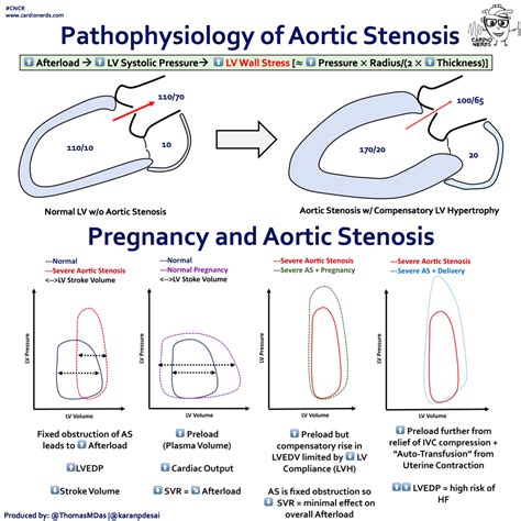 Aortic Stenosis A Practical Approach Presented By The Cardionerds