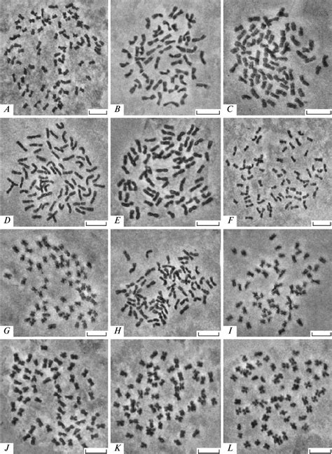 Somatic Metaphase Chromosomes In A Pacifica A C × Morifolium