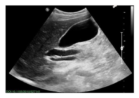 Nephropocus On Twitter Pocus Quiz What Does This Classic Double