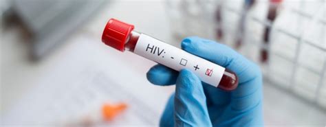 Cercet Torii Au Identificat O Variant Mai Virulent A Hiv