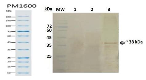 Western Blot Analysis Of Hsp E Fusion Protein Expression In Hek T