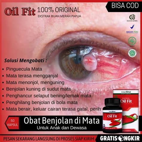 Oil Fit Kapsul Obat Pinguecula Mata Obat Penghilang Benjolan Di Bola