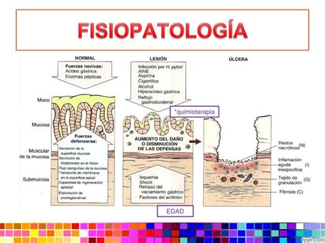 Ppt Gastritis Aguda Powerpoint Presentation Id2161181