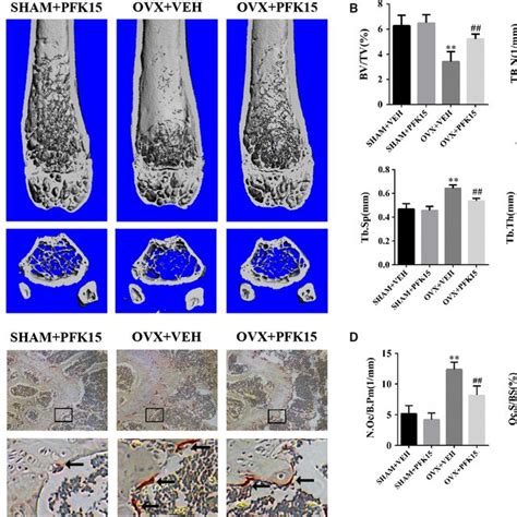 PFK15 Prevents Ovariectomyinduced Bone Loss A Representative