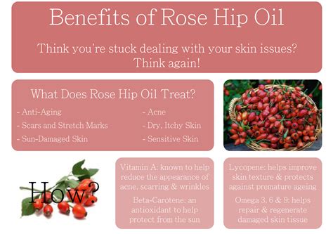 Easy Infographic The Benefits Of Rose Hip Oil Rosehip Oil Rosehip