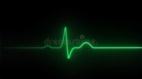 Cardiogram Het Hart Sloeg Electrocardiogram Stock Video Video Of