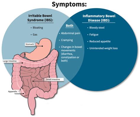 IBS Irritable Bowel Syndrome My Gastro Wellness