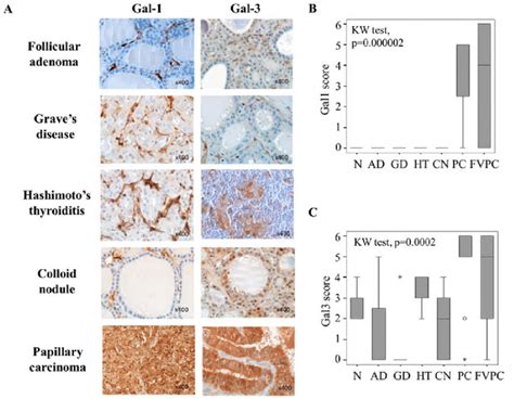 Evaluation Of Galectin 1 And Galectin 3 Expression In Benign And