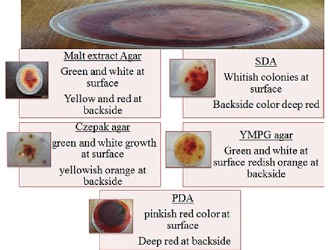 Screening Of Pigment Production On 5 Different Solid Culture Media At