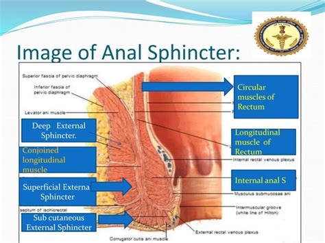 Anal Fissure And Fistula In Ano Ppt By Dr Anil Kumar Assistant Professor