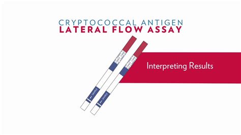 Immys Cryptococcal Antigen Lateral Flow Assay Training Part 1 Of 2