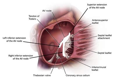 Electrophysiology Study And Ablation Of Atrioventricular Nodal