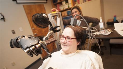 Paralyzed Woman Moves Prosthetic Arm With Her Brain