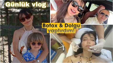 Botoks Ve Dolgu Deneyimim G Nl K Vlog Karaman Gurbet I Vlog