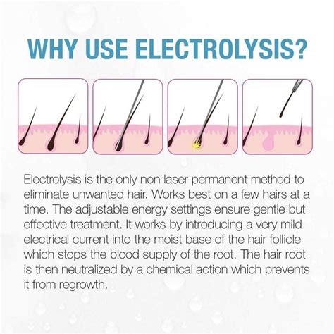 Clean And Easy Deluxe Home Electrolysis 家庭用電気脱毛器 並行輸入品 無痛 顔 体 非レーザー 永久脱毛 Ay015grkjn アメリカ輸入プロ