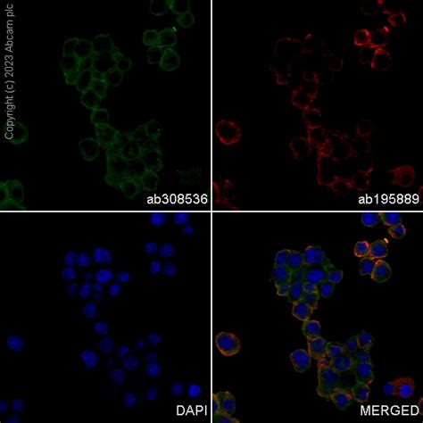 Alexa Fluor 488 Anti Ras 抗体 EPR3255 ab308536 アブカム