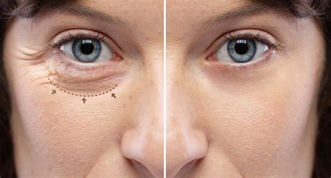 How To Make Your Eyes Look Smaller With Without Makeup