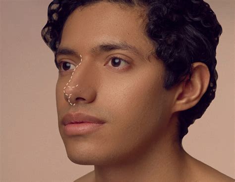 Non Surgical Nose Jobs And Rhinoplasty Treatments Cosmetic Connection