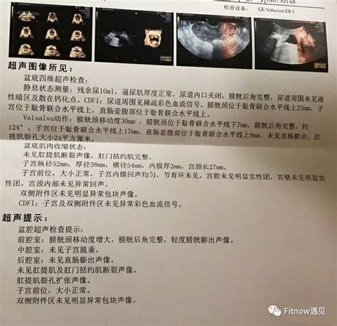 教你如何看懂盆底肌检查报告锻炼