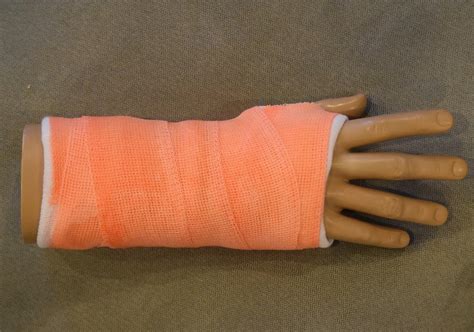 Basic Short Arm Cast