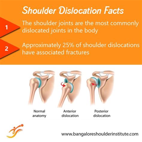 Read More About Shoulder Dislocation Here Shoulder