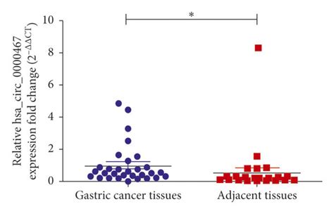 Expression Of Hsa Circ 0000467 In GC Tissues And Cell Lines A The