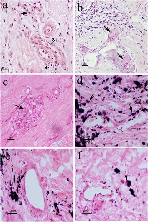 Light Micrographs Of Hematoxylin And Eosin Stained Sections Of