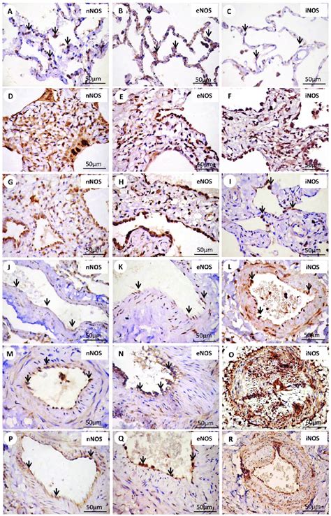 Immunohistochemical Staining With Nnos Enos And Inos Cell Expressions