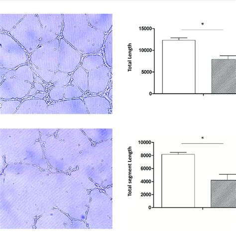 Tube Formation Assay Huvecs Co Cultured With D And D Cultured