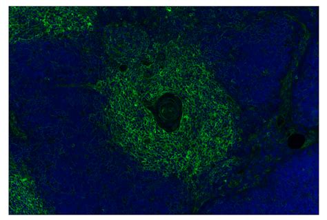 Mhc Class I Emr8 5 Mouse Mab Alexa Fluor® 488 Conjugate Cell Signaling Technology