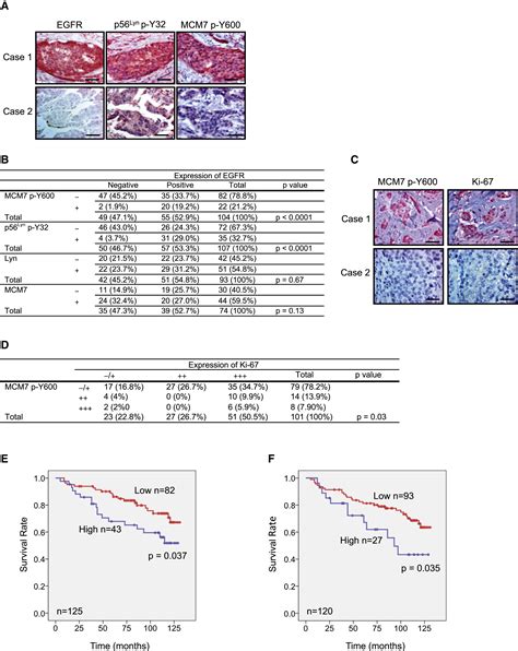 Epidermal Growth Factor Receptor Potentiates MCM7 Mediated DNA