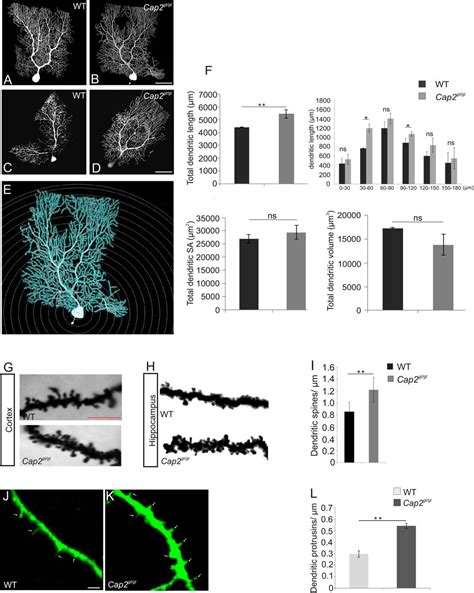 Neuronal Actin Dynamics Spine Density And Neuronal Dendritic