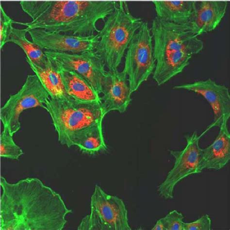 Triple Staining Of An Endothelial Cell Monolayer Two Days After