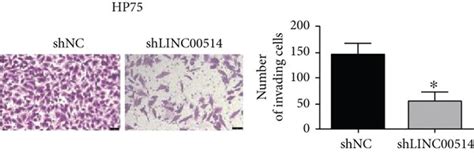 Silencing Of Linc00514 Hinders Pa Cell Proliferation And Invasion Hp75