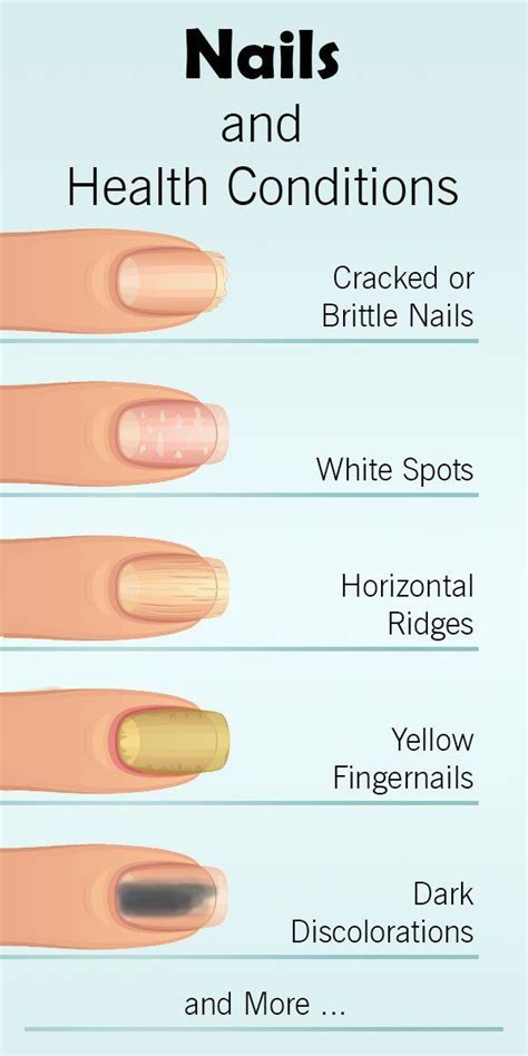 How Your Nails Warn You About Serious Health Conditions The Health