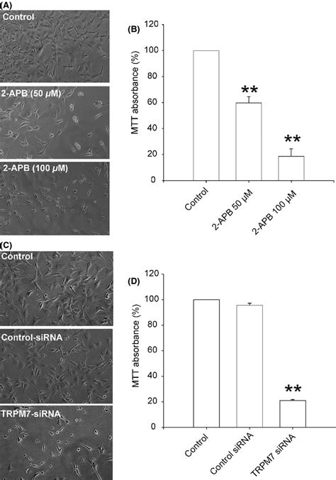 Suppression Of Trpm7 Inhibits Proliferation Migration And Invasion Of