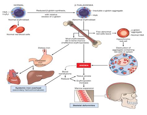 Doctors Network Important Presentation About Thalassemia Microcytic