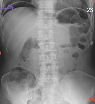 Xray Practice Flashcards Quizlet