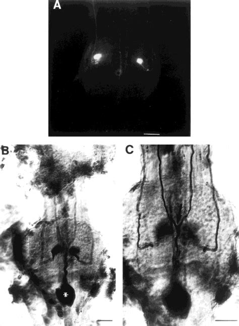 Immunocytochemical Staining For Serotonin In The First Abdominal