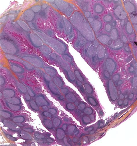 Lymph Node Histology Diagram Quizlet