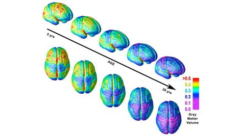 Brain Development