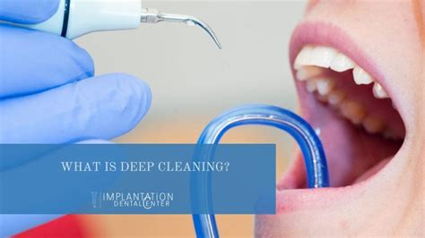 Dental Deep Cleaning Scaling And Root Planing